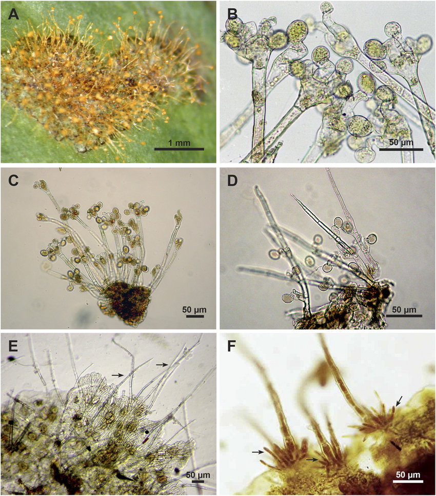 Vết bệnh do tảo Cephaleuros virescens dưới kính hiển vi